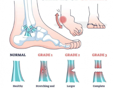 Bong mắt cá chân