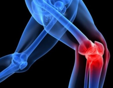 VIÊM KHỚP GỐI