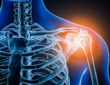 VIÊM KHỚP VAI – SHOULDER ARTHRITIS